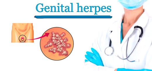 genital-herpes-symptom